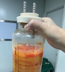 万宁水动力吸脂手术要做多久？